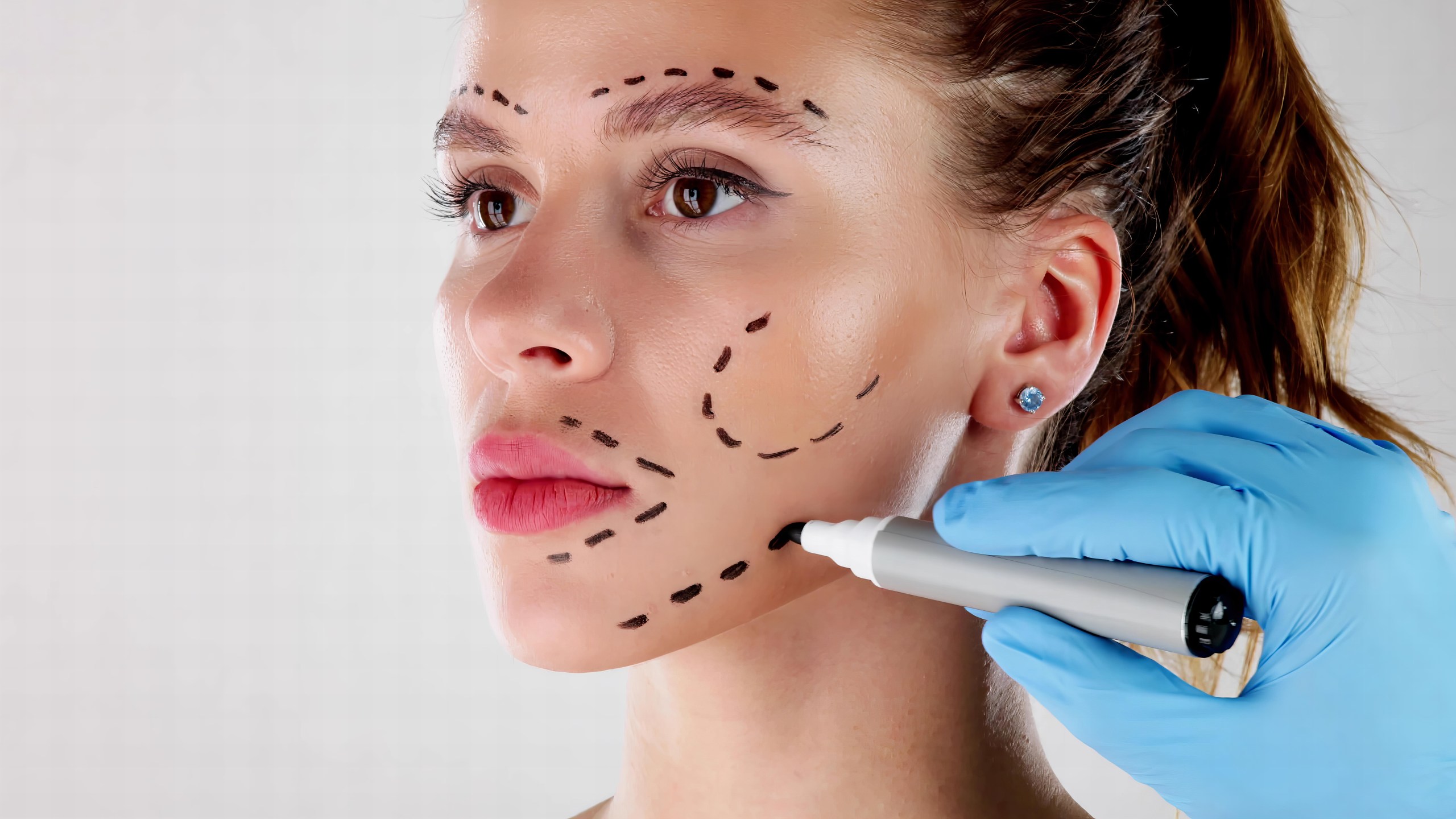 10 Plastic Surgeries